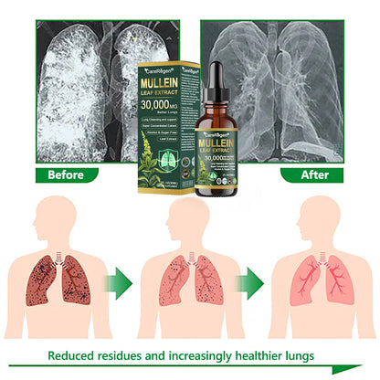 𝗢𝗳𝗳𝗶𝗰𝗶𝗮𝗹 𝗦𝘁𝗼𝗿𝗲:CareRegen® 𝗢𝗿𝗴𝗮𝗻𝗶𝗰 𝗟𝘂𝗻𝗴 𝗖𝗹𝗲𝗮𝗻𝘀𝗶𝗻𝗴 𝗠𝘂𝗹𝗹𝗲𝗶𝗻 𝗟𝗲𝗮𝗳 𝗘𝘅𝘁𝗿𝗮𝗰𝘁 𝗗𝗿𝗼𝗽𝘀  𝐂𝐥𝐢𝐧𝐢𝐜𝐚𝐥𝐥𝐲 𝐩𝐫𝐨𝐯𝐞𝐧, 𝐡𝐢𝐠𝐡𝐥𝐲 𝐜𝐨𝐧𝐜𝐞𝐧𝐭𝐫𝐚𝐭𝐞𝐝 𝐟𝐨𝐫𝐦𝐮𝐥𝐚 𝐭𝐡𝐚𝐭 𝐫𝐞𝐥𝐢𝐞𝐯𝐞𝐬 𝐜𝐨𝐮𝐠𝐡, 𝐩𝐡𝐥𝐞𝐠𝐦, 𝐚𝐬𝐭𝐡𝐦𝐚 & 𝐂𝐎𝐏𝐃 — 𝐛𝐫𝐞𝐚𝐭𝐡𝐞 𝐞𝐚𝐬𝐢𝐞𝐫, 𝐟𝐚𝐬𝐭𝐞𝐫.🌵🍋‍🟩